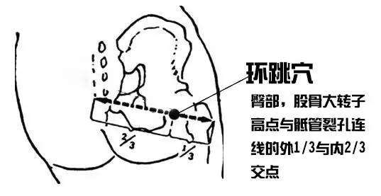 环跳穴的功效与作用，环跳穴的准确位置图中医养生知识补肾